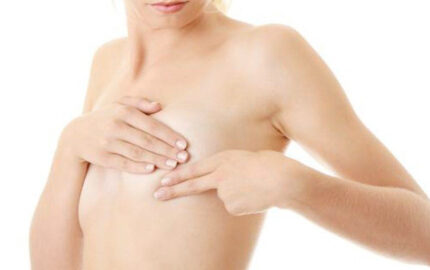 Ejercicios para prevenir el edema del brazo tras una mastectomía